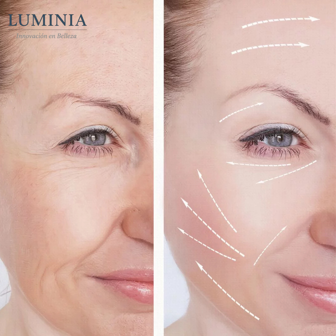 Retinal Shot Tightening Booster™ - Lifting visible sin agujas en 7 días